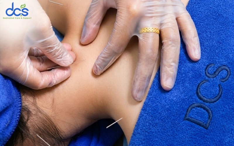 Châm cứu theo hướng dẫn chuyên môn