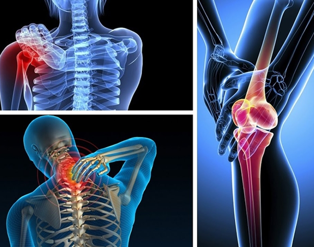 NHỮNG BIẾN CHỨNG NGUY HIỂM KHI KHÔNG PHỤC HỒI CHỨC NĂNG VẬN ĐỘNG?